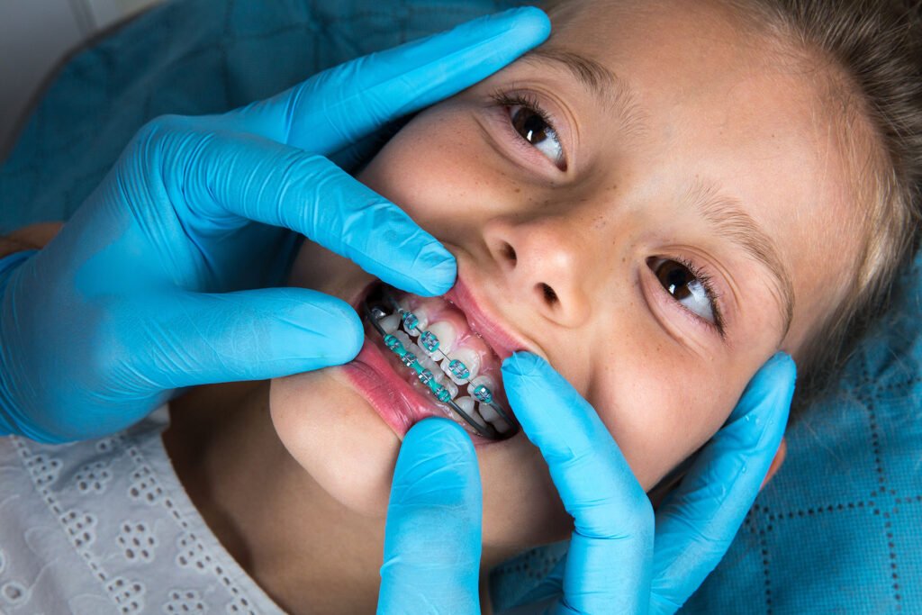 childrens braces